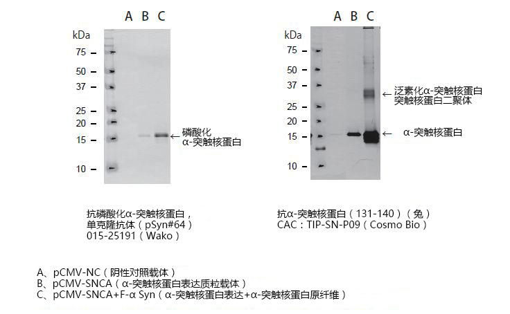 α-突触核蛋白聚集检测试剂盒 (ALPHA)-Synuclein Aggregation Assay Kit