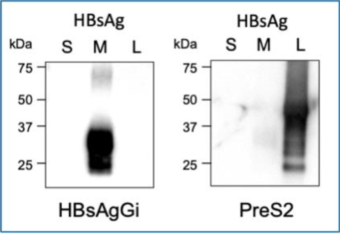 HBsAgGi抗体 & HBsAgGi ELISA试剂盒                              乙型肝炎病毒特异性检测